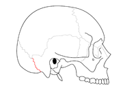 Occipitomastoid suture. It separates occipital bone and mastoid portion of temporal bone.