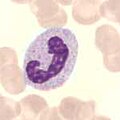 Neutrophiler Granulozyt, stabkernig