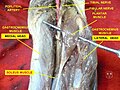 Plantaris muscle